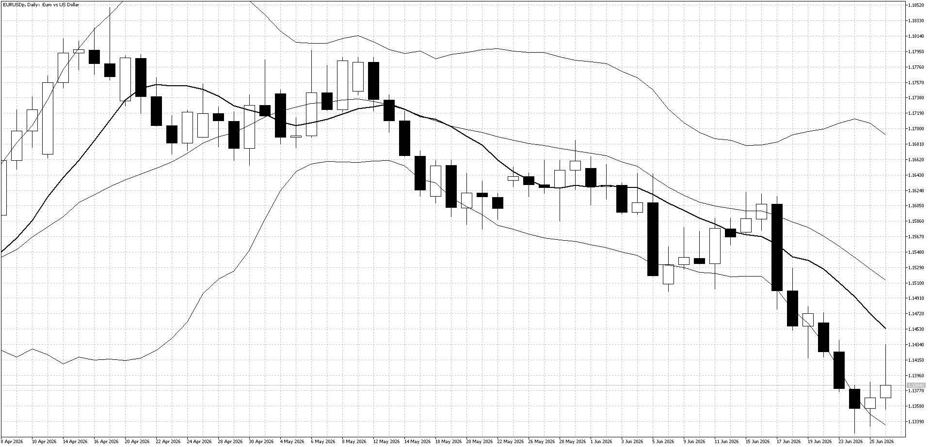 USD/JPY Daily Chart (Bollinger Band and 10 day moving average)