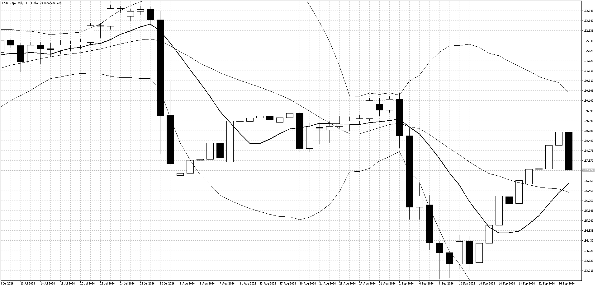 USD/JPY Daily Chart (Bollinger Band and 10 day moving average)